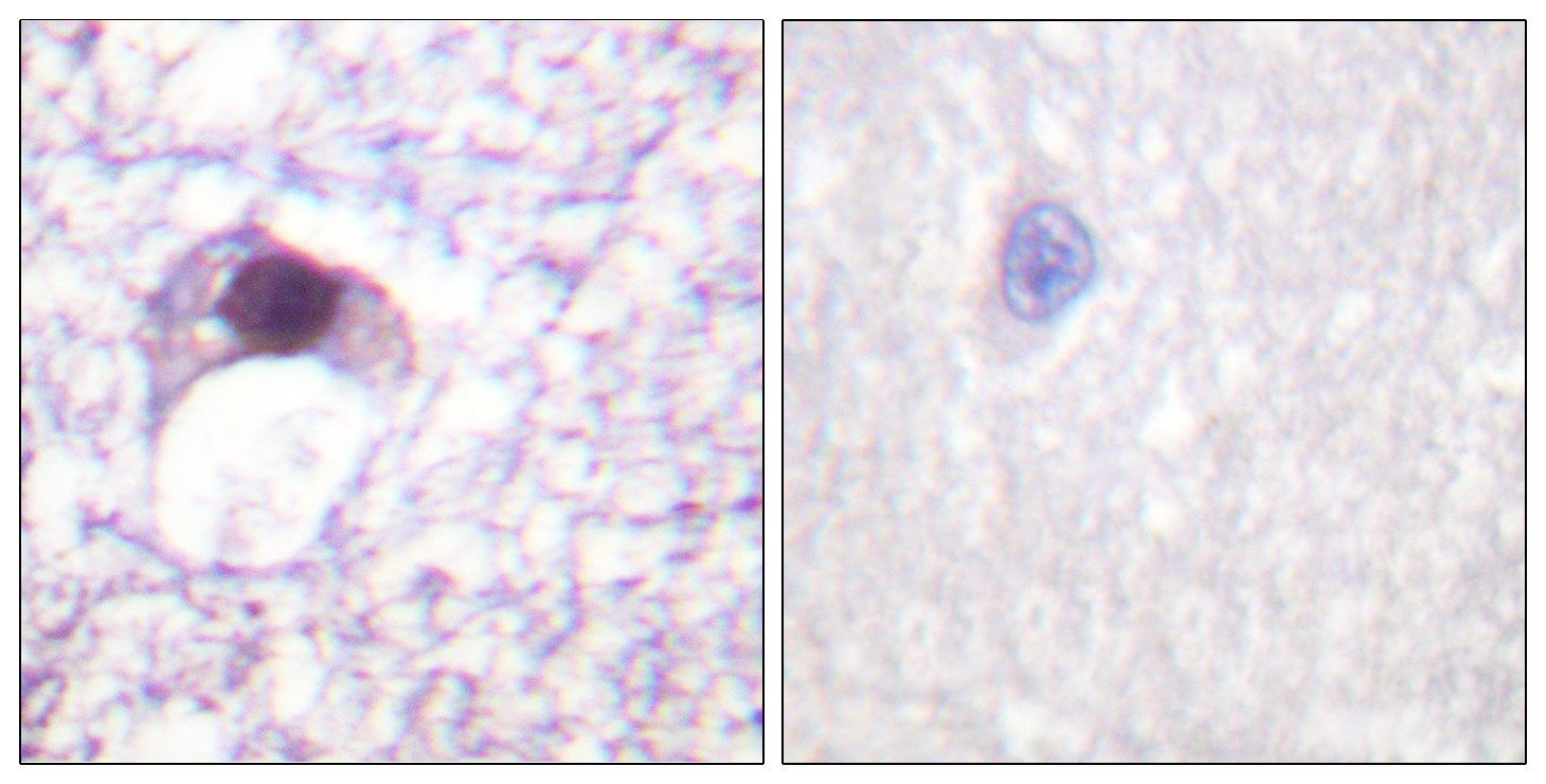 Immunohistochemistry (Formalin/PFA-fixed paraffin-embedded sections) - Anti-E2F6 antibody (AB53061)