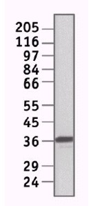 Western blot - Anti-E2F6 antibody [TFE61] (AB11952)