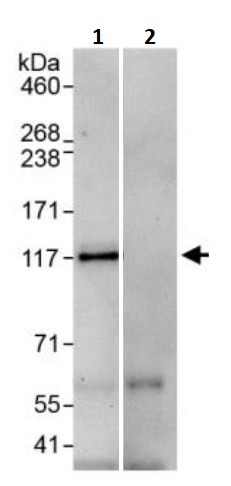 Immunoprecipitation - Anti-E2F7 antibody (AB245655)