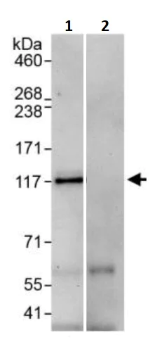 Immunoprecipitation - Anti-E2F7 antibody (AB245655)