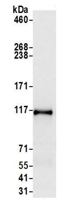 Immunoprecipitation - Anti-E2F8 antibody (AB109596)