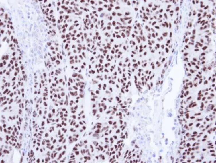 Immunohistochemistry (Formalin/PFA-fixed paraffin-embedded sections) - Anti-E3 SUMO-protein ligase PIAS4/PIASy antibody (AB137500)