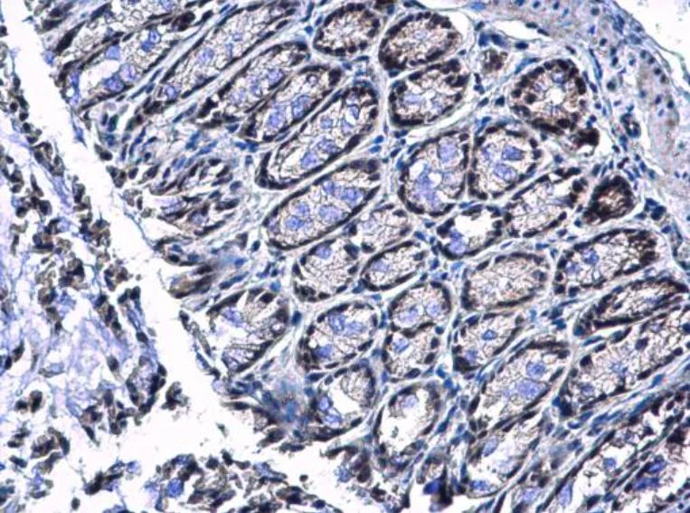 Immunohistochemistry (Formalin/PFA-fixed paraffin-embedded sections) - Anti-E3 SUMO-protein ligase PIAS4/PIASy antibody (AB137500)