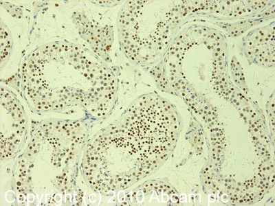 Immunohistochemistry (Formalin/PFA-fixed paraffin-embedded sections) - Anti-E3 SUMO-protein ligase PIAS4/PIASy antibody (AB58416)