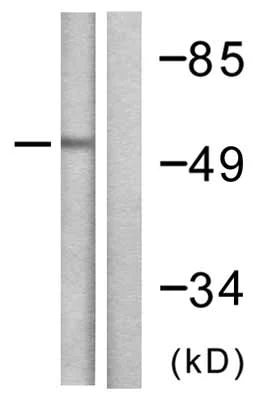 Western blot - Anti-E3 SUMO-protein ligase PIAS4/PIASy antibody (AB58416)