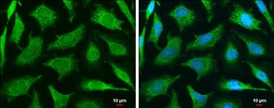 Immunocytochemistry/ Immunofluorescence - Anti-E3 ubiquitin-protein ligase MUL1 antibody (AB155511)