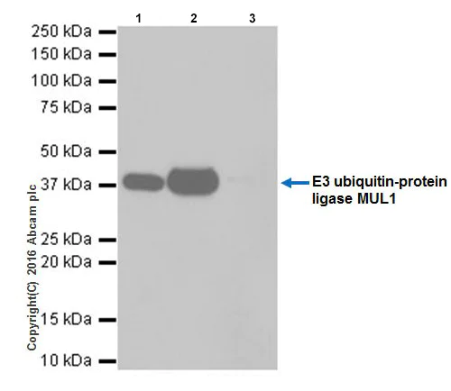 Immunoprecipitation - Anti-E3 ubiquitin-protein ligase MUL1 antibody [EPR20241] (AB209263)