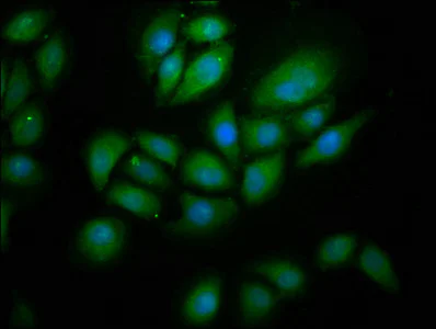 Immunocytochemistry/ Immunofluorescence - Anti-E3 ubiquitin-protein ligase RNF213 antibody (AB238677)
