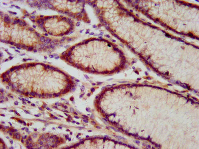 Immunohistochemistry (Formalin/PFA-fixed paraffin-embedded sections) - Anti-E3 ubiquitin-protein ligase RNF213 antibody (AB238677)