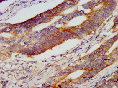 Immunohistochemistry (Formalin/PFA-fixed paraffin-embedded sections) - Anti-E3 ubiquitin-protein ligase RNF213 antibody (AB238677)