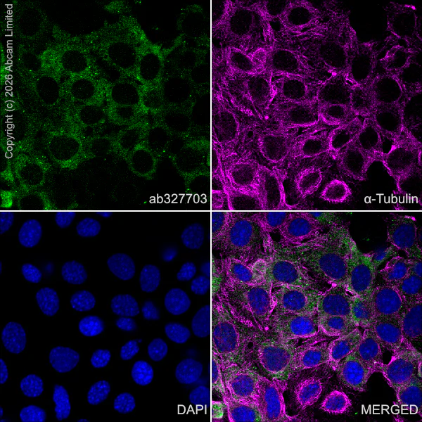 Immunocytochemistry/ Immunofluorescence - Anti-E3 ubiquitin-protein ligase RNF213 antibody [EPR28972-85] (AB327703)