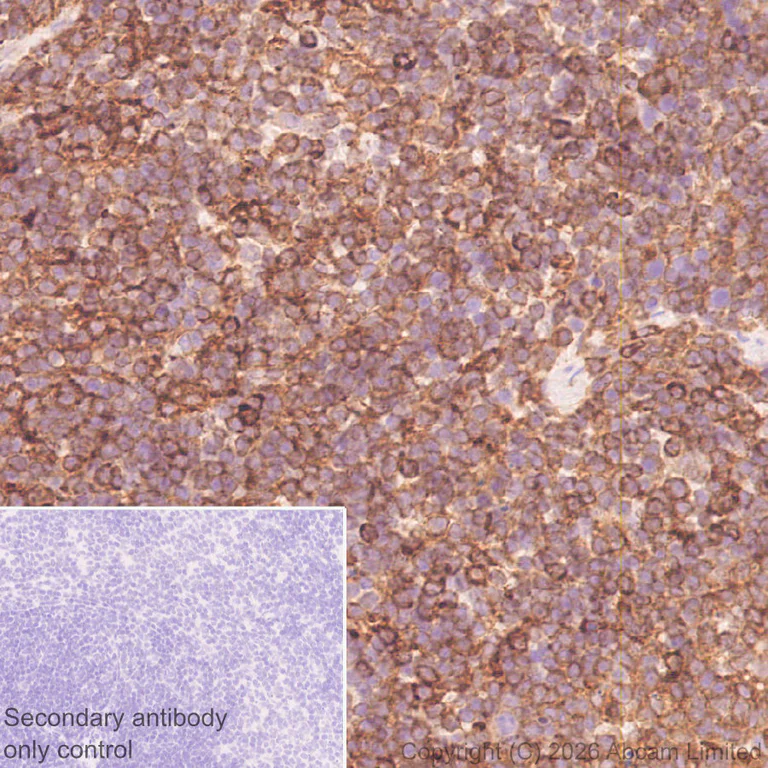 Immunohistochemistry (Formalin/PFA-fixed paraffin-embedded sections) - Anti-E3 ubiquitin-protein ligase RNF213 antibody [EPR28972-85] (AB327703)