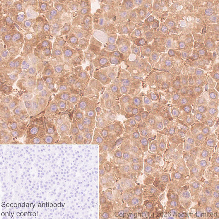 Immunohistochemistry (Formalin/PFA-fixed paraffin-embedded sections) - Anti-E3 ubiquitin-protein ligase RNF213 antibody [EPR28972-85] (AB327703)