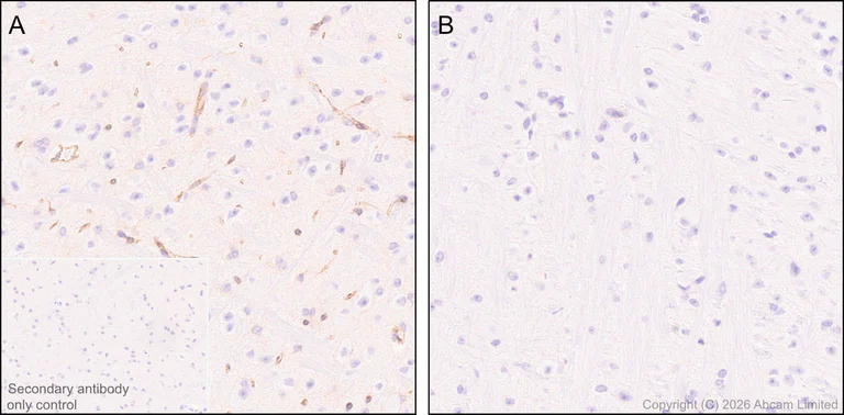 Immunohistochemistry (Formalin/PFA-fixed paraffin-embedded sections) - Anti-E3 ubiquitin-protein ligase RNF213 antibody [EPR28972-85] (AB327703)