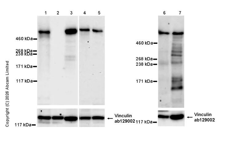 Western blot - Anti-E3 ubiquitin-protein ligase RNF213 antibody [EPR28972-85] (AB327703)