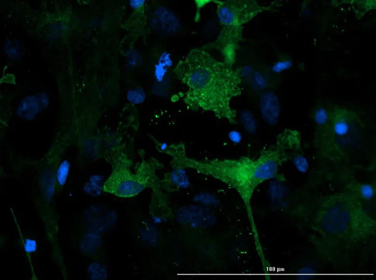 Immunocytochemistry/ Immunofluorescence - Anti-EAAT1 antibody (AB235203)