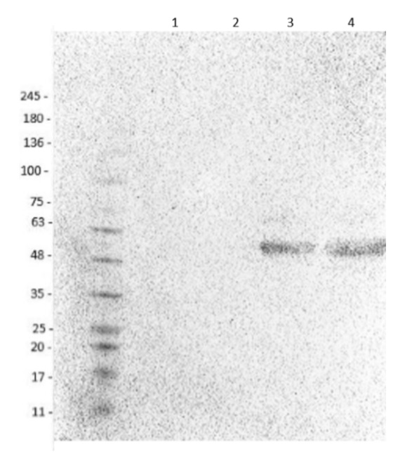 Western blot - Anti-EAAT1 antibody (AB235203), expandable thumbnail