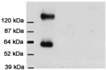 Western blot - Anti-EAAT1 antibody (AB416)