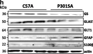 Western blot - Anti-EAAT1 antibody (AB416)