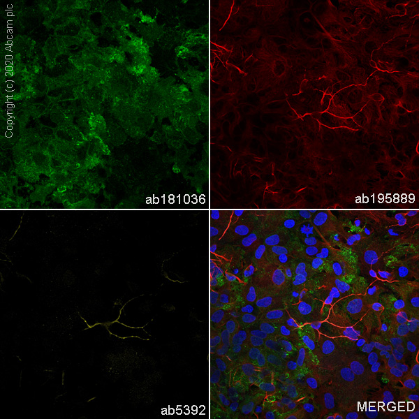 Immunocytochemistry/ Immunofluorescence - Anti-EAAT1 antibody [EPR12686] (AB181036), expandable thumbnail