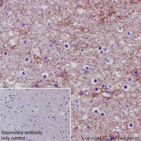 Immunohistochemistry (Formalin/PFA-fixed paraffin-embedded sections) - Anti-EAAT1 antibody [EPR12686] (AB181036)