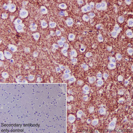 Immunohistochemistry (Formalin/PFA-fixed paraffin-embedded sections) - Anti-EAAT1 antibody [EPR12686] (AB181036)