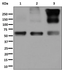 Western blot - Anti-EAAT1 antibody [EPR12686] (AB181036)