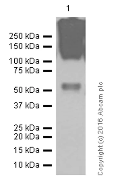 Western blot - Anti-EAAT1 antibody [EPR12686] (AB181036)