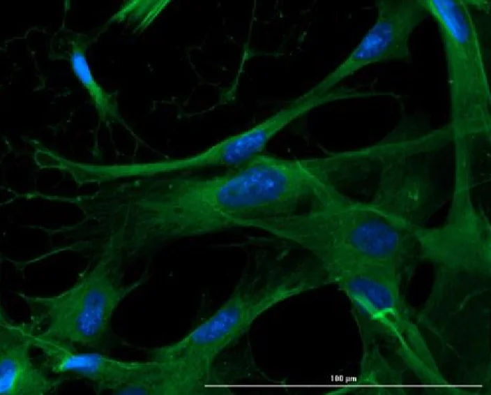 Immunocytochemistry/ Immunofluorescence - Anti-EAAT2 antibody (AB235202)