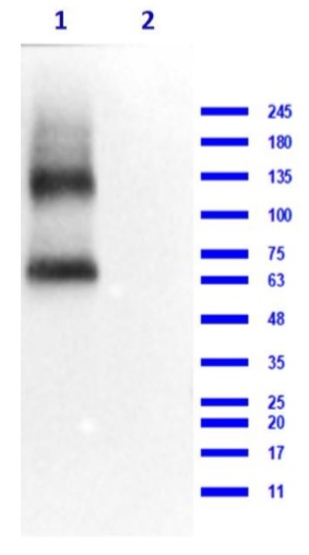 Western blot - Anti-EAAT2 antibody (AB235202), expandable thumbnail