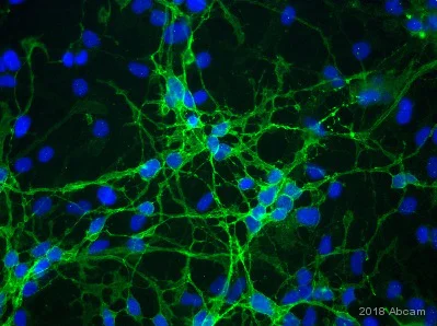 Immunocytochemistry - Anti-EAAT2 antibody (AB41621)