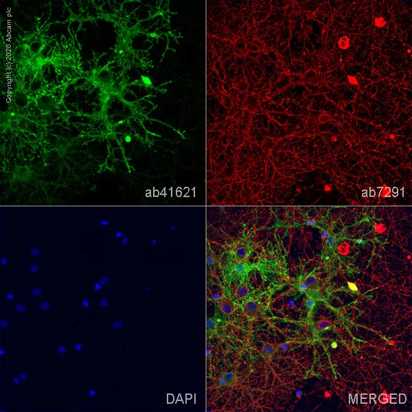 Immunocytochemistry - Anti-EAAT2 antibody (AB41621)