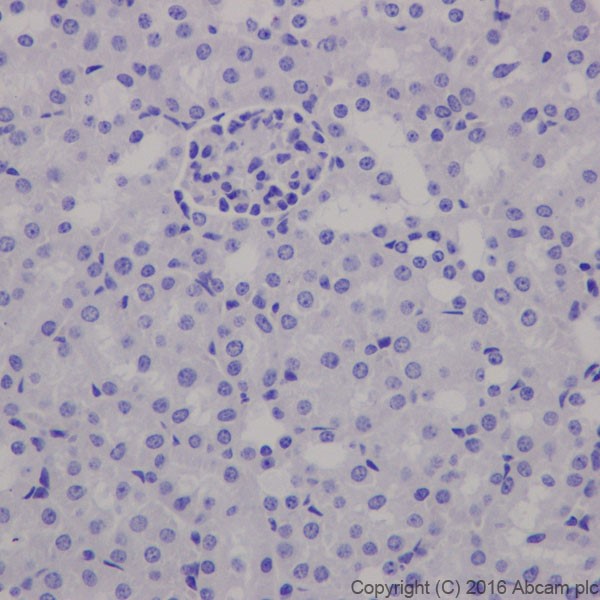 Immunohistochemistry (Formalin/PFA-fixed paraffin-embedded sections) - Anti-EAAT2 antibody [EPR19794] (AB205247), expandable thumbnail