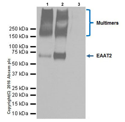 Immunoprecipitation - Anti-EAAT2 antibody [EPR19794] (AB205247), expandable thumbnail