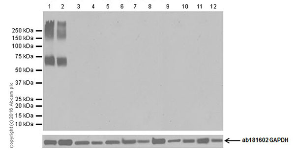 Western blot - Anti-EAAT2 antibody [EPR19794] (AB205247), expandable thumbnail
