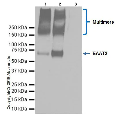 Immunoprecipitation - Anti-EAAT2 antibody [EPR19794] - BSA and Azide free (AB251423)
