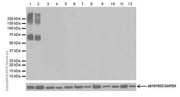 Western blot - Anti-EAAT2 antibody [EPR19794] - BSA and Azide free (AB251423)