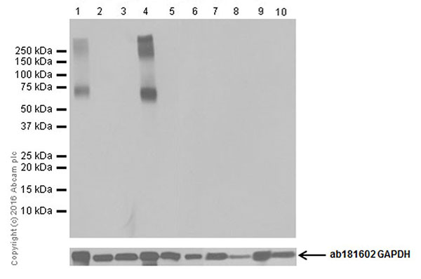 Western blot - Anti-EAAT2 antibody [EPR19798] (AB205248), expandable thumbnail