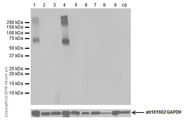 Western blot - Anti-EAAT2 antibody [EPR19798] (AB205248)