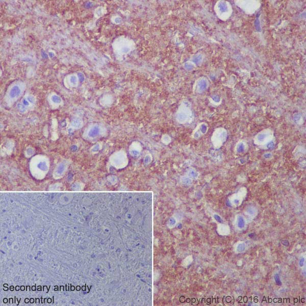 Immunohistochemistry (Formalin/PFA-fixed paraffin-embedded sections) - Anti-EAAT2 antibody [EPR19798] - BSA and Azide free (AB271970), expandable thumbnail