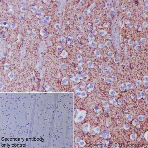 Immunohistochemistry (Formalin/PFA-fixed paraffin-embedded sections) - Anti-EAAT2 antibody [EPR19798] - BSA and Azide free (AB271970), expandable thumbnail