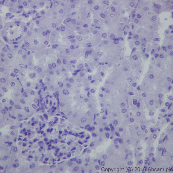 Immunohistochemistry (Formalin/PFA-fixed paraffin-embedded sections) - Anti-EAAT2 antibody [EPR19798] - BSA and Azide free (AB271970), expandable thumbnail
