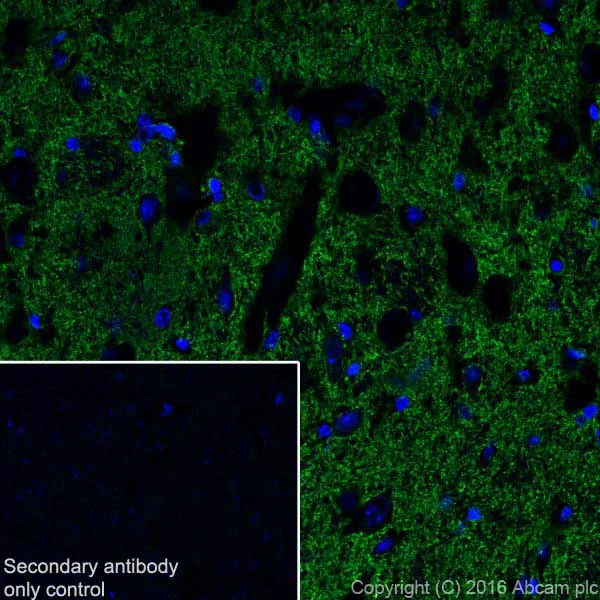 Immunohistochemistry (Frozen sections) - Anti-EAAT2 antibody [EPR19798] - BSA and Azide free (AB271970)