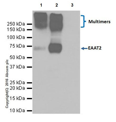 Immunoprecipitation - Anti-EAAT2 antibody [EPR19798] - BSA and Azide free (AB271970), expandable thumbnail