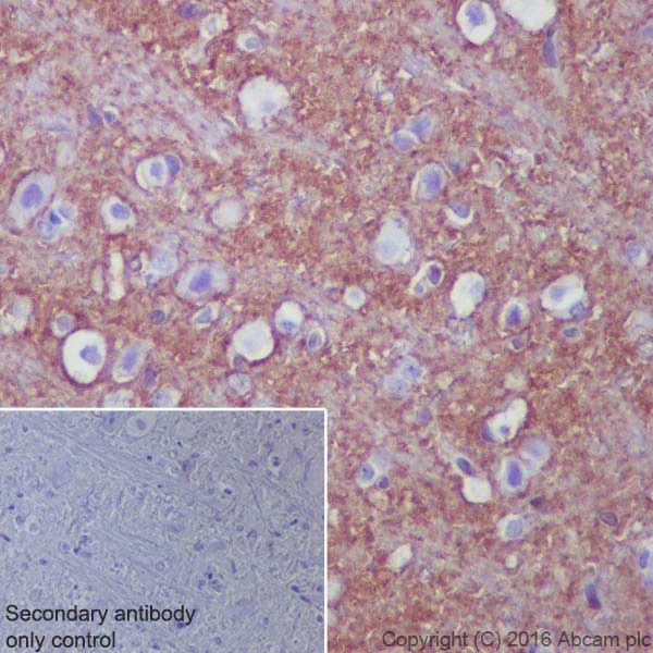 Immunohistochemistry (Formalin/PFA-fixed paraffin-embedded sections) - Anti-EAAT2 antibody [EPR19798] - Low endotoxin, Azide free (AB223538)