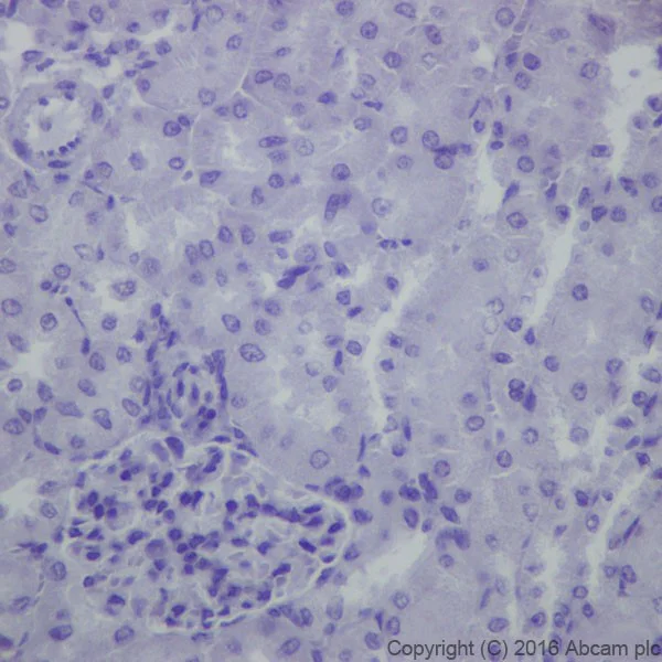 Immunohistochemistry (Formalin/PFA-fixed paraffin-embedded sections) - Anti-EAAT2 antibody [EPR19798] - Low endotoxin, Azide free (AB223538)