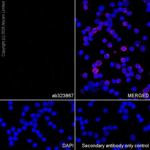 Immunocytochemistry/ Immunofluorescence - Anti-EAAT2 antibody [EPR29552-528] (AB323867)