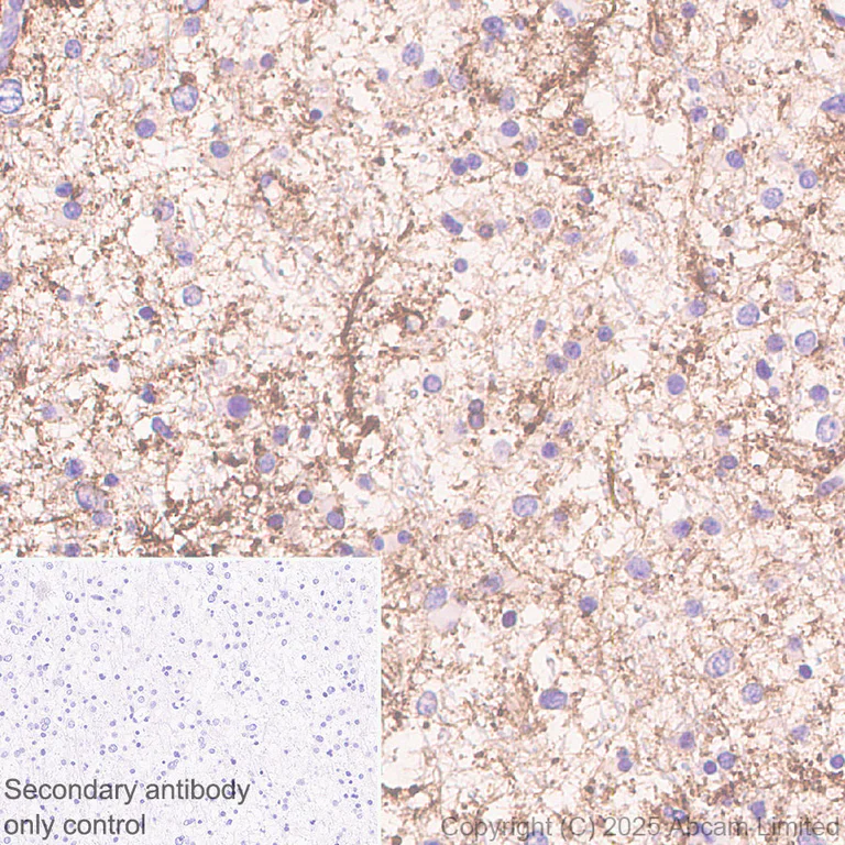 Immunohistochemistry (Formalin/PFA-fixed paraffin-embedded sections) - Anti-EAAT2 antibody [EPR29552-528] (AB323867)