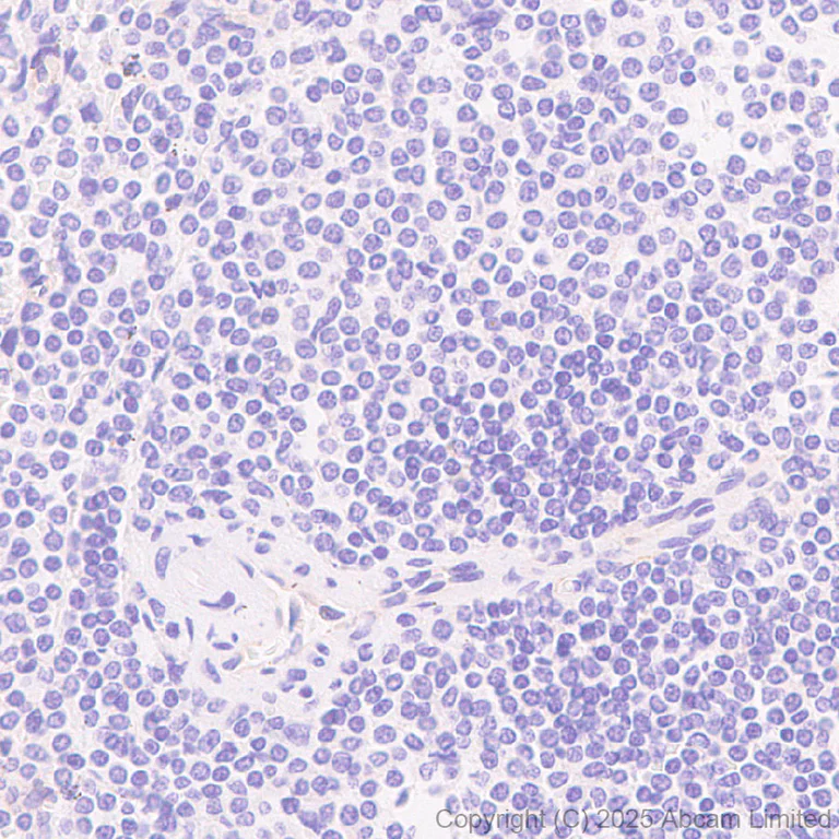 Immunohistochemistry (Formalin/PFA-fixed paraffin-embedded sections) - Anti-EAAT2 antibody [EPR29552-528] (AB323867)