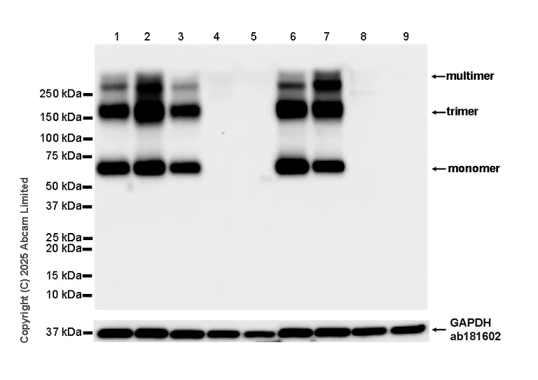 Western blot - Anti-EAAT2 antibody [EPR29552-528] (AB323867)
